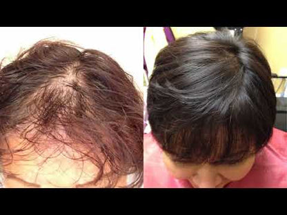 3 Piece Hair Growth System (8oz) w/ FREE BloUP